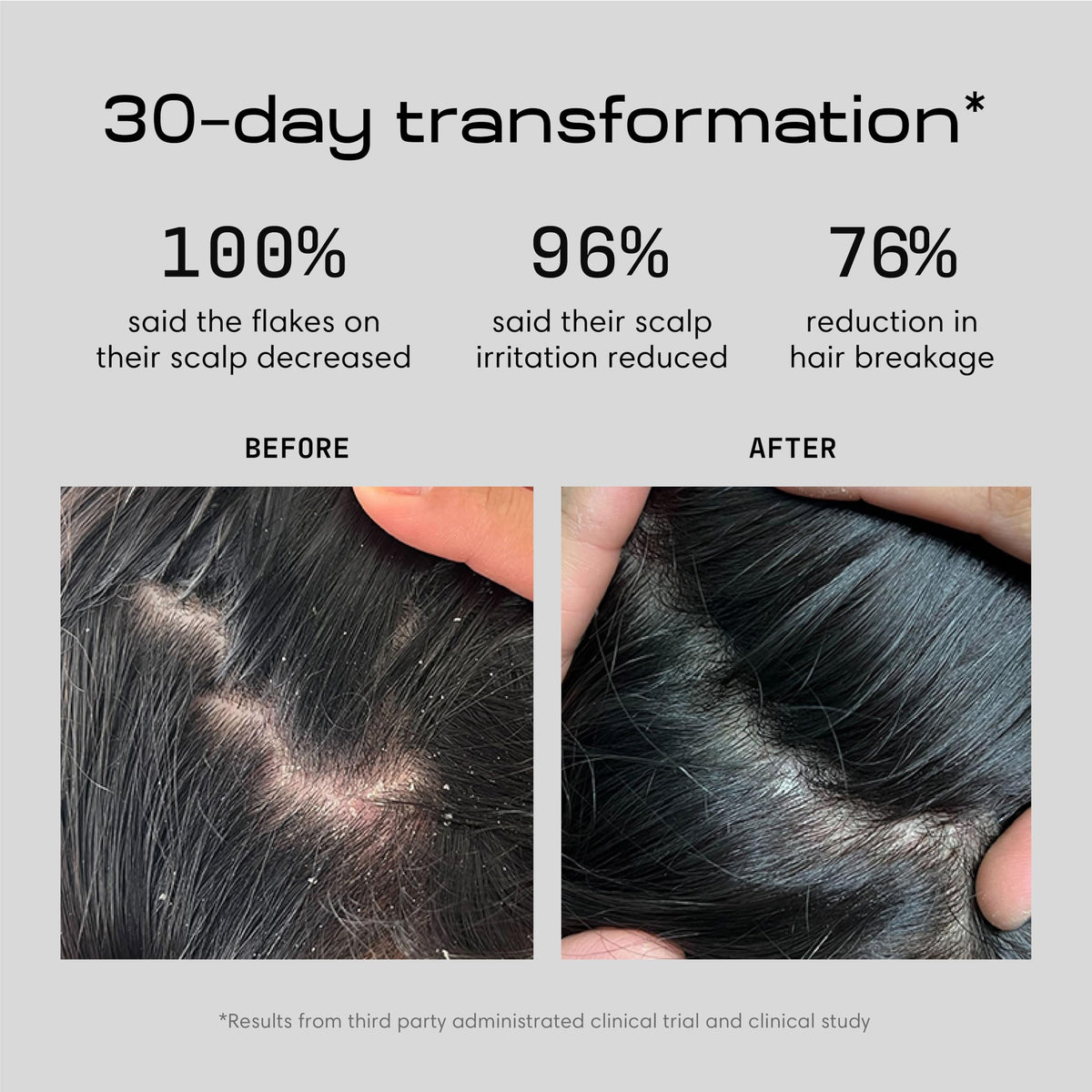 Jupiter Nourishing Conditioner for Scalp Hydration and Softer Hair
