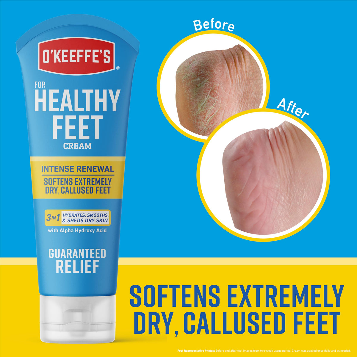 O'Keeffe's Healthy Feet Intense Renewal Foot Cream with Urea & AHA, 3 oz