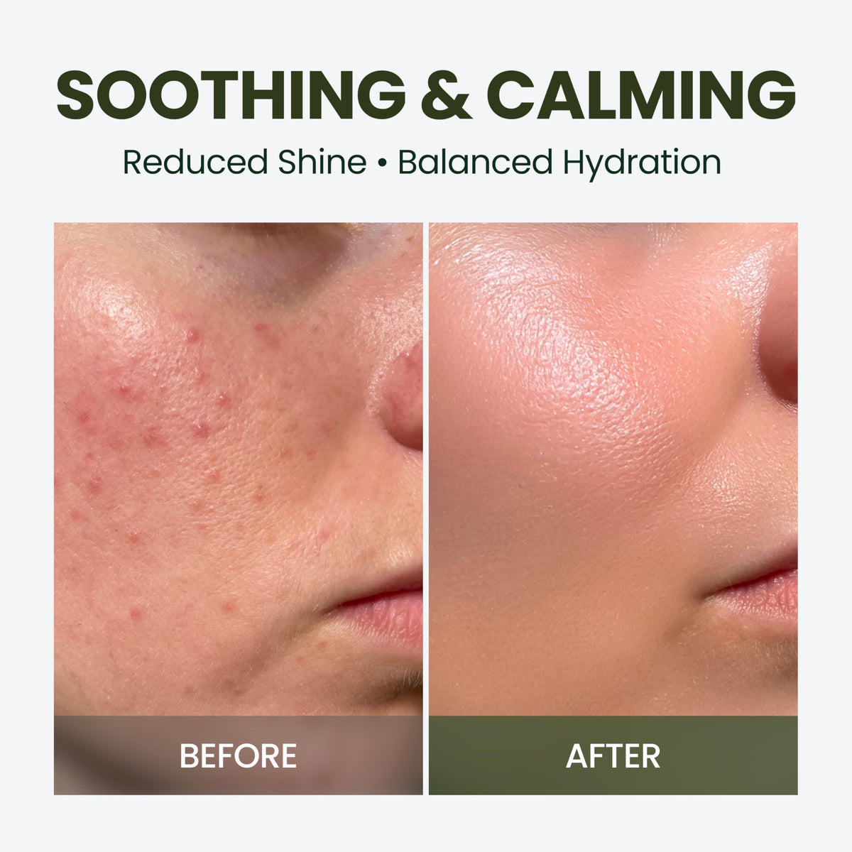 HyCicaMue Skincare