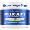 AOSORW Folliculitis & Acne Treatment Cream with Salicylic Acid, 100g
