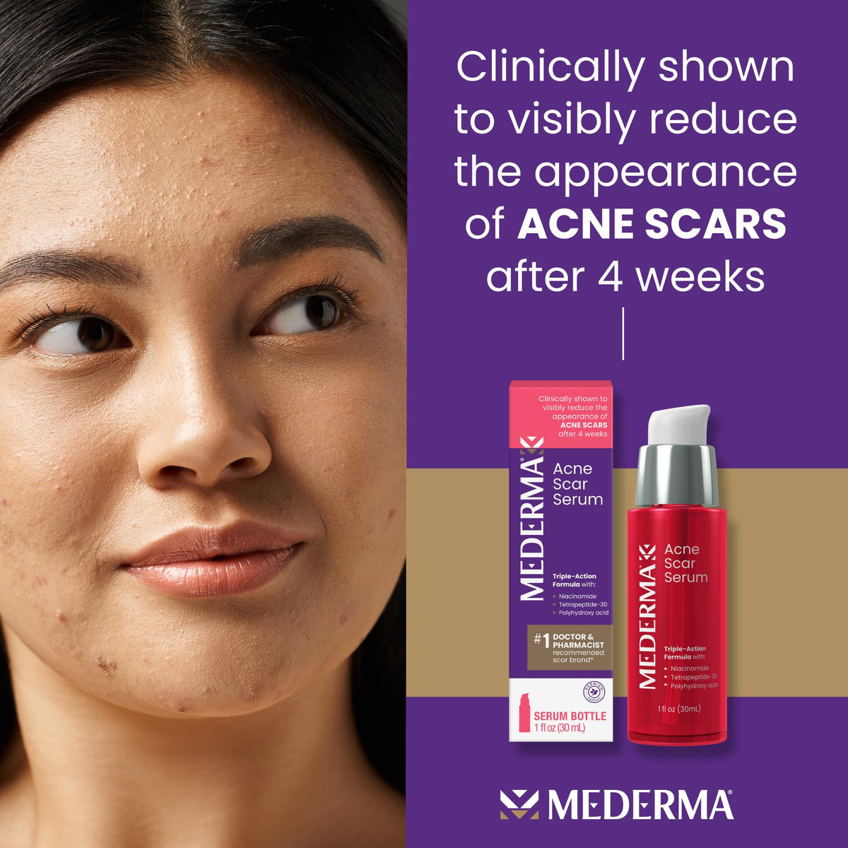 Mederma Acne Scar Serum with Niacinamide, Tetrapeptide-30 and Polyhydroxy Acid