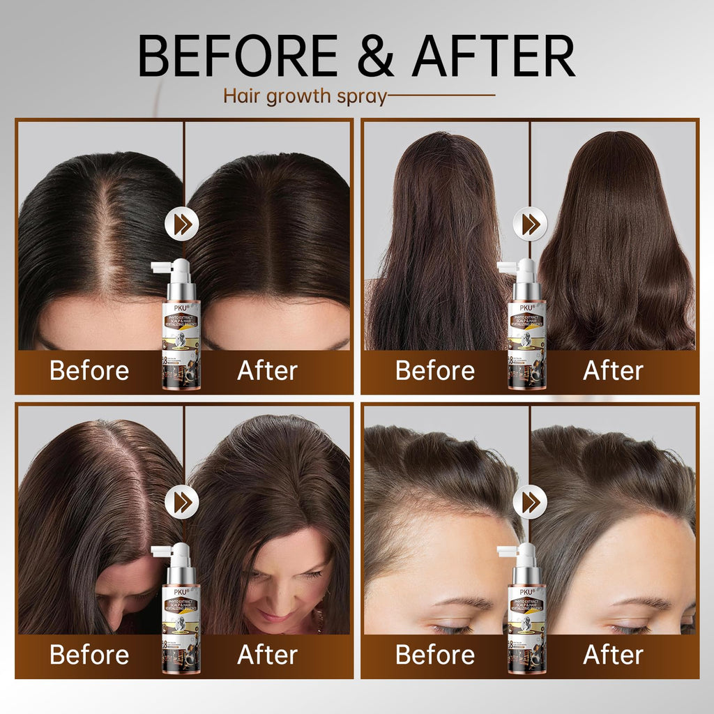 PKU Hair Growth Spray with Biotin & Rosemary Oil