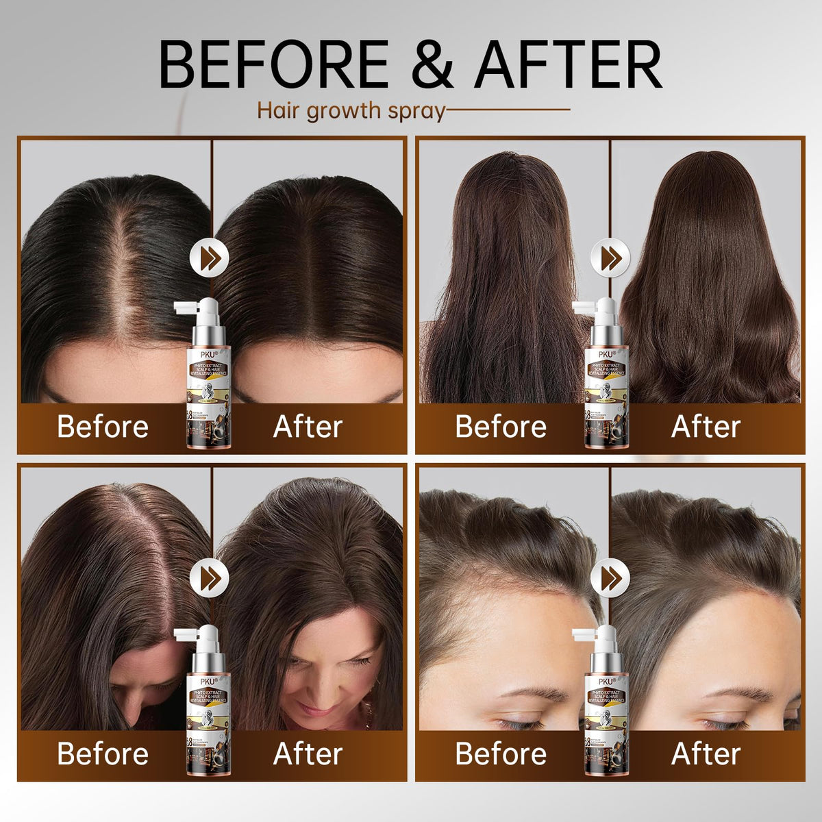 PKU Hair Growth Spray with Biotin & Rosemary Oil