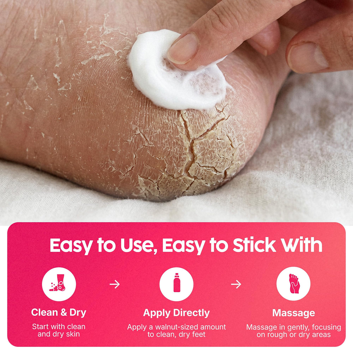 FOOTLOGIX Rough Skin Formula Foot Mousse with Urea, Spiraleen, Tea Tree Oil & Aloe Vera