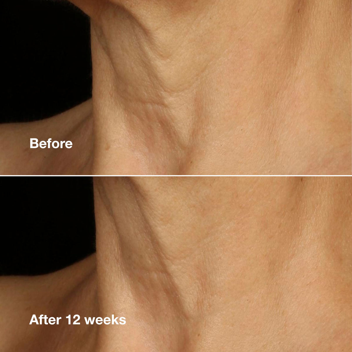 Clinique Smart Clinical Repair Anti-Aging Face & Neck Cream
