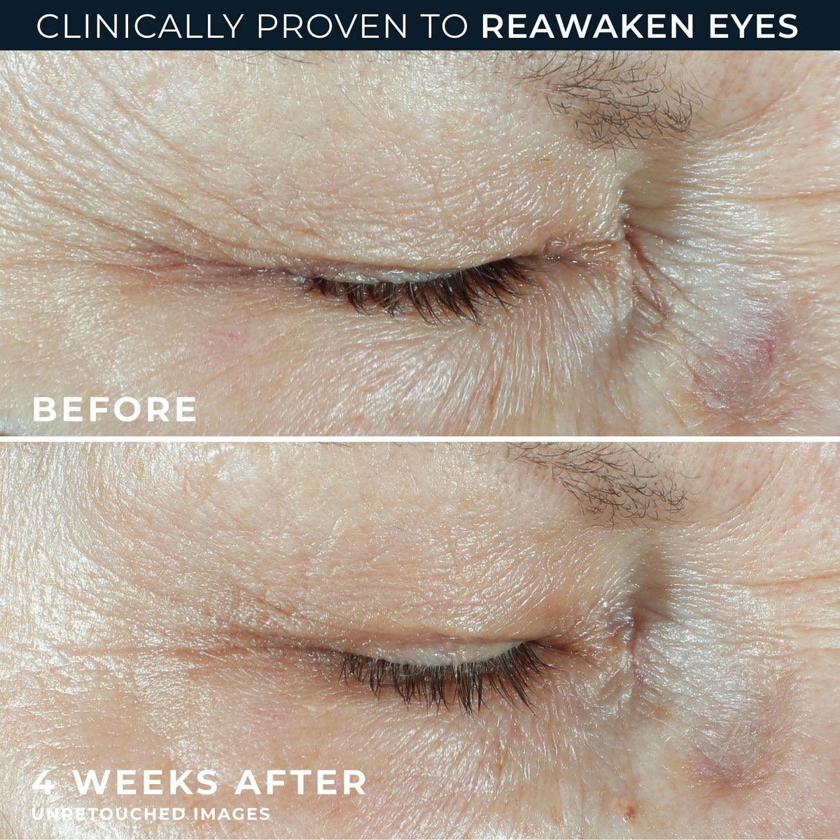 RoC Hyaluronic Acid Anti-Aging Under Eye Cream