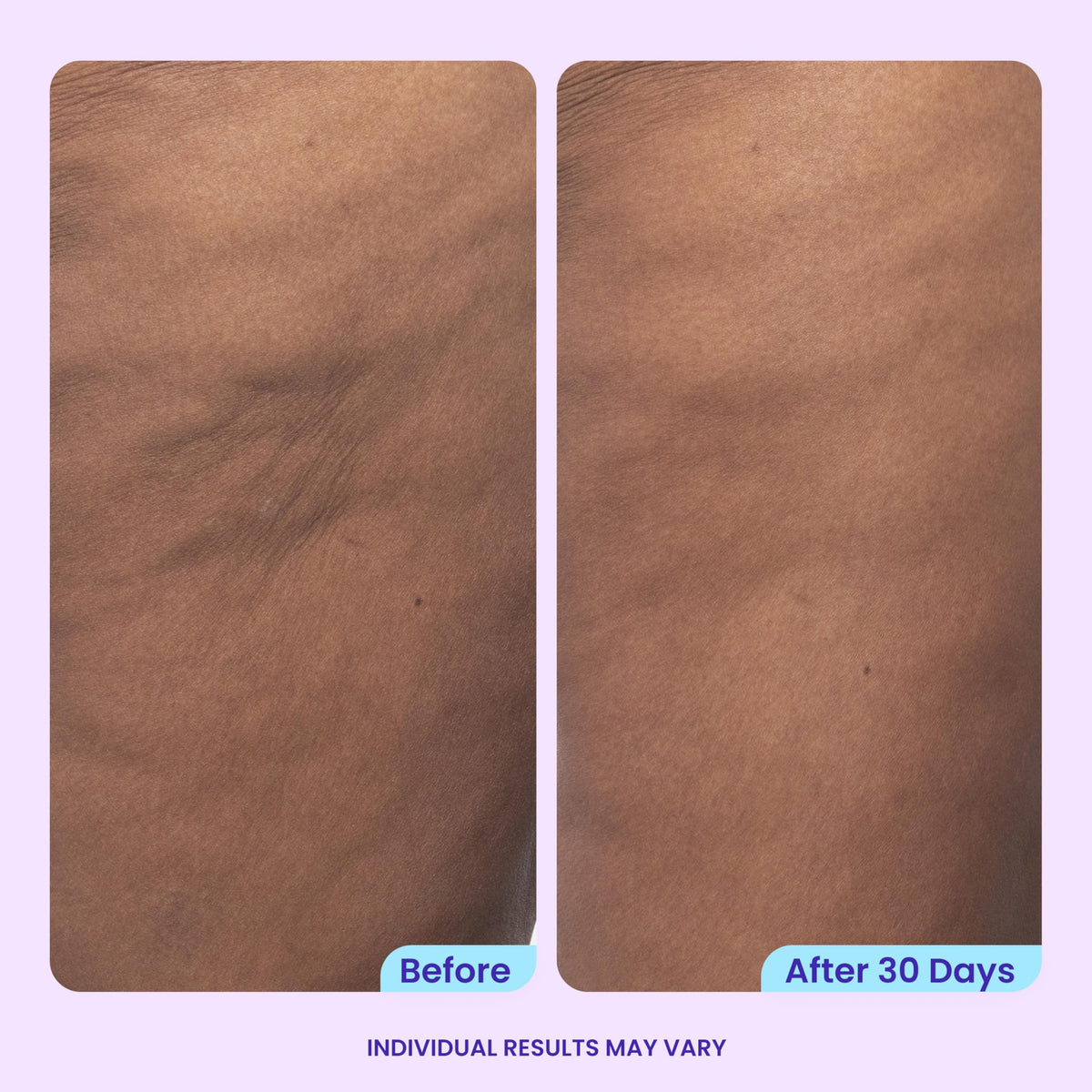 goPure Firming Butt & Thigh Cream with 8% MaxLift3 Complex