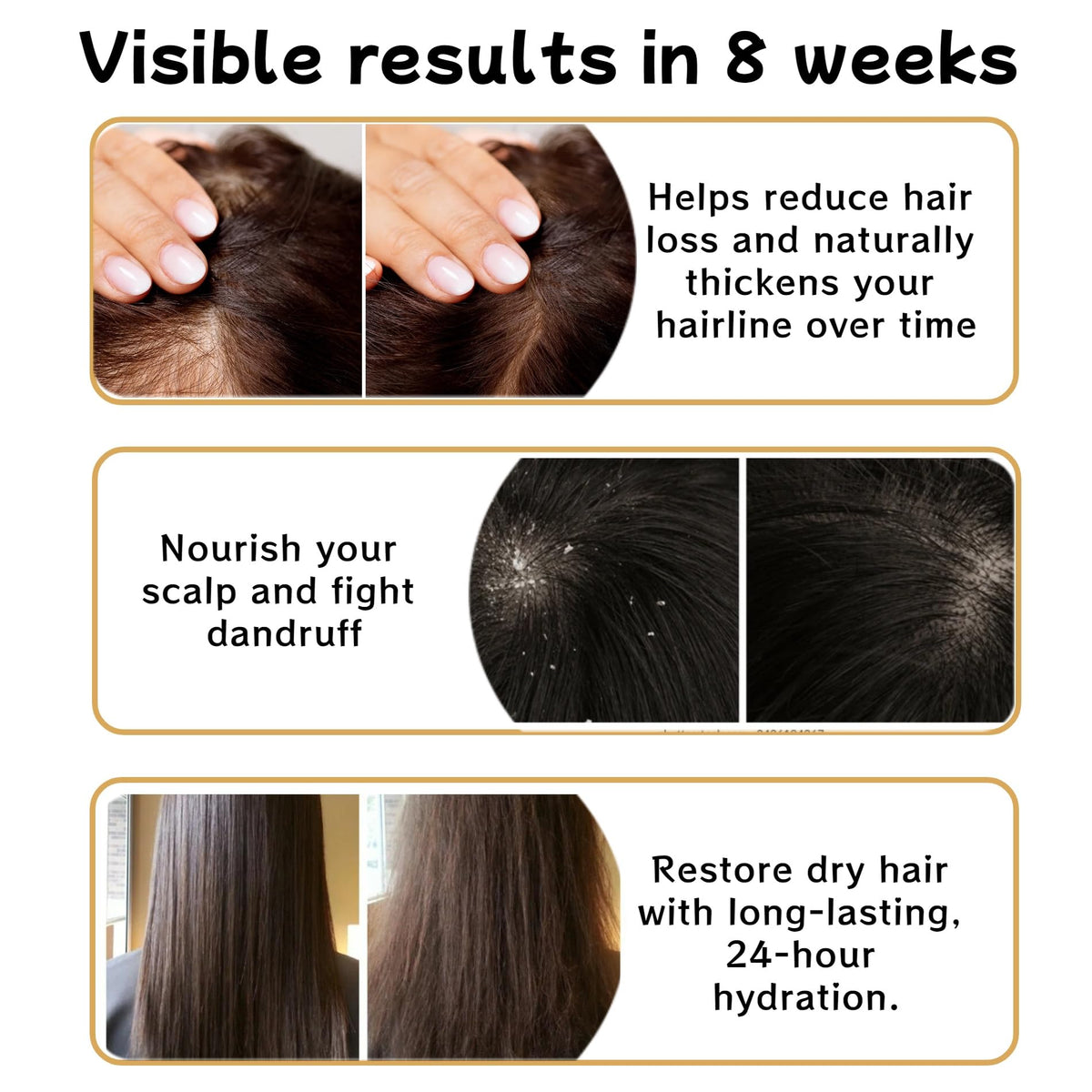 Anti-Hair Loss Shampoo with Ginger & Ginseng Extracts
