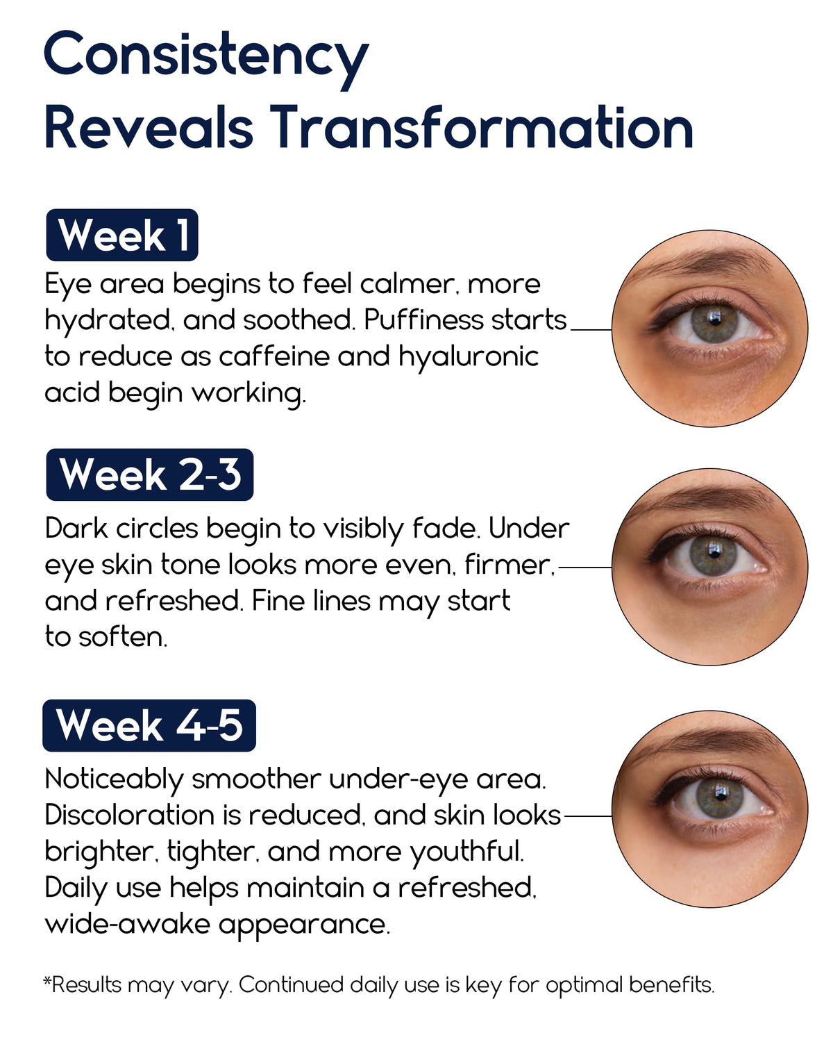 Under Eye Cream with Retinol, Hyaluronic Acid & Caffeine
