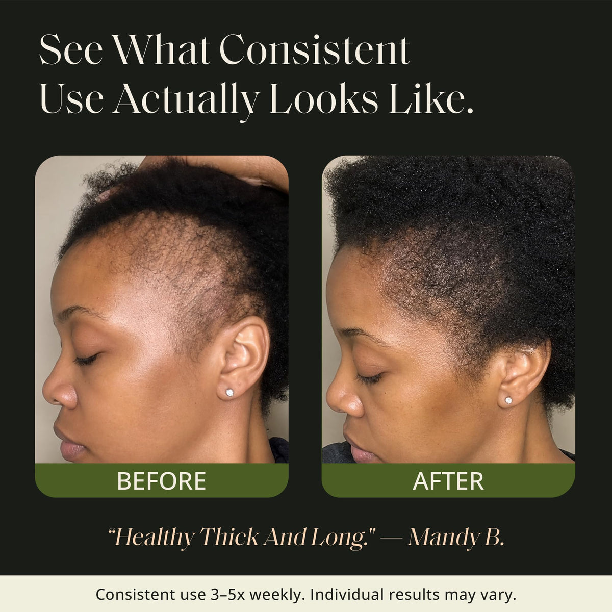 Glossed By Nae Mega Strength Voodoo Hair Growth Oil 4oz
