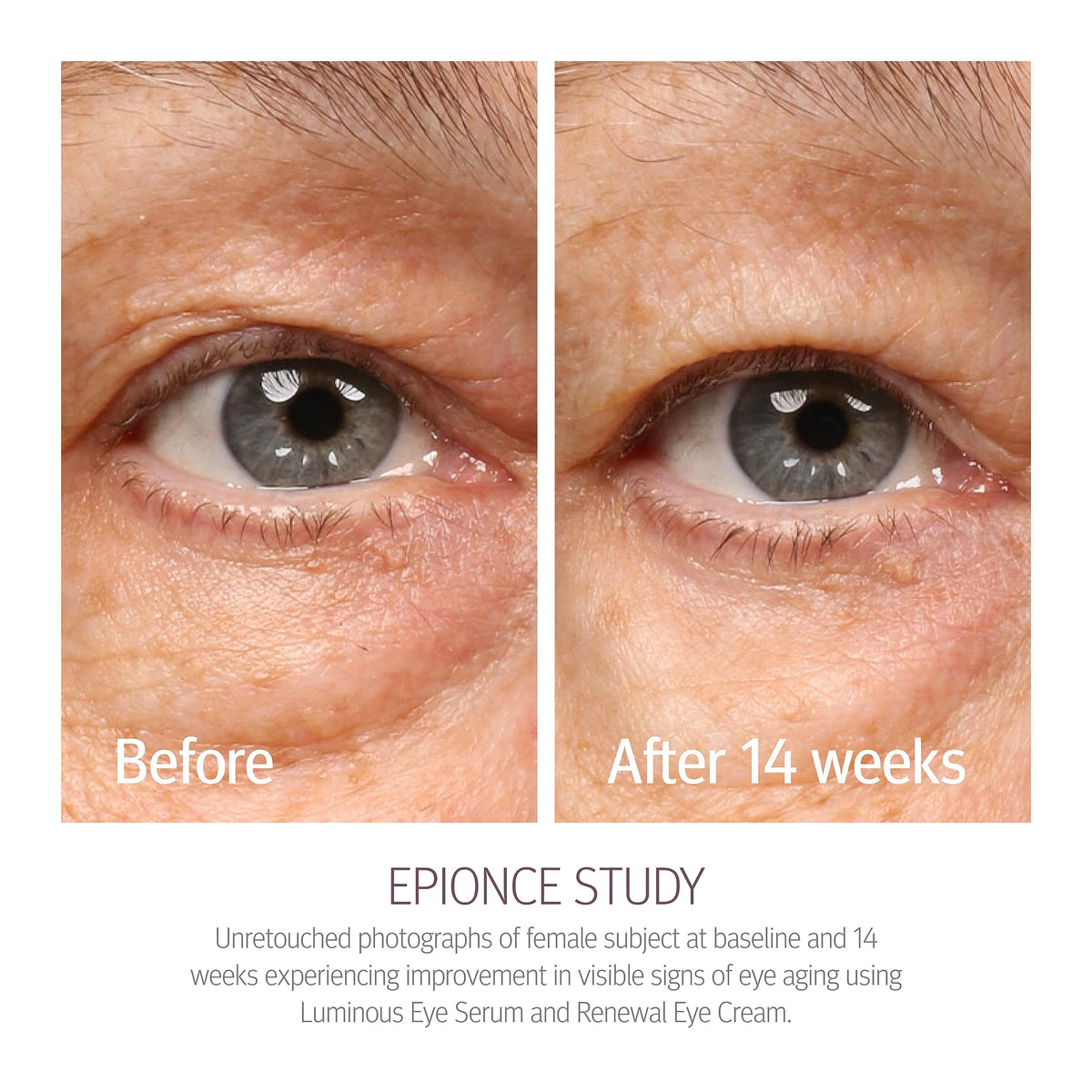 Epionce Renewal Eye Cream Anti-Aging Under Eye Treatment