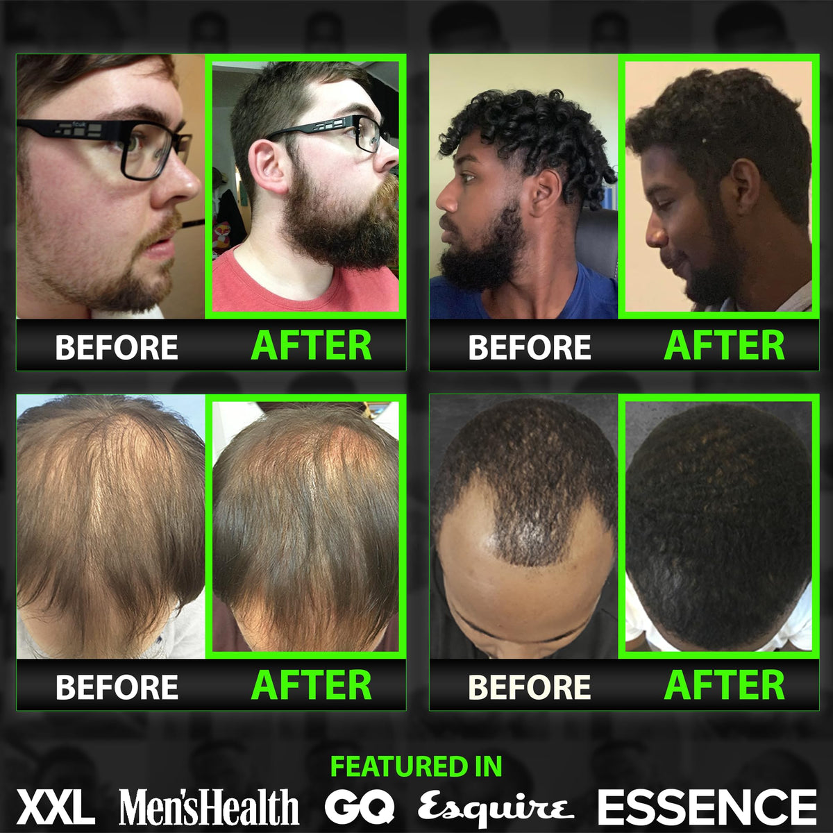 GROW Hair & Beard Growth Oil Serum