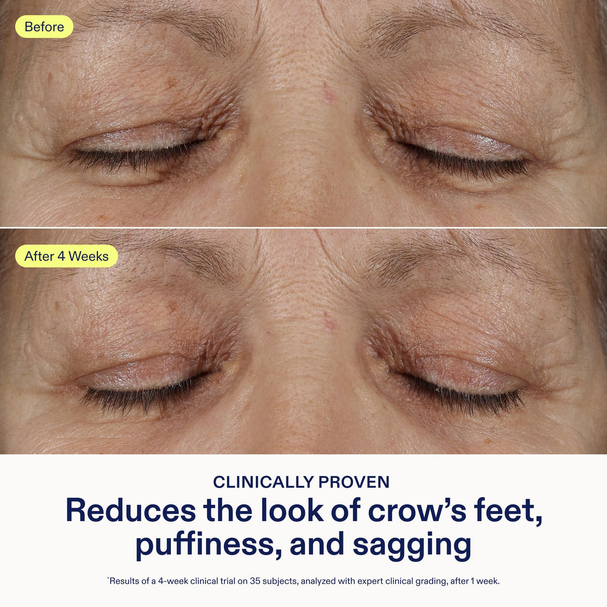 Skinfix Triple Lipid Eye Treatment Fragrance-Free Eye Cream, 0.5 fl oz