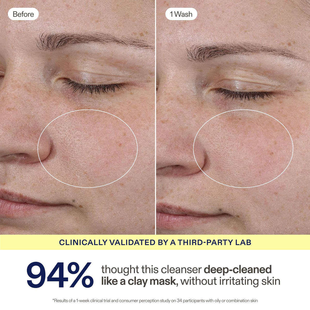 Skinfix Balancing Soft-Foam Clay Cleanser for Oily, Combination & Acne-Prone Skin