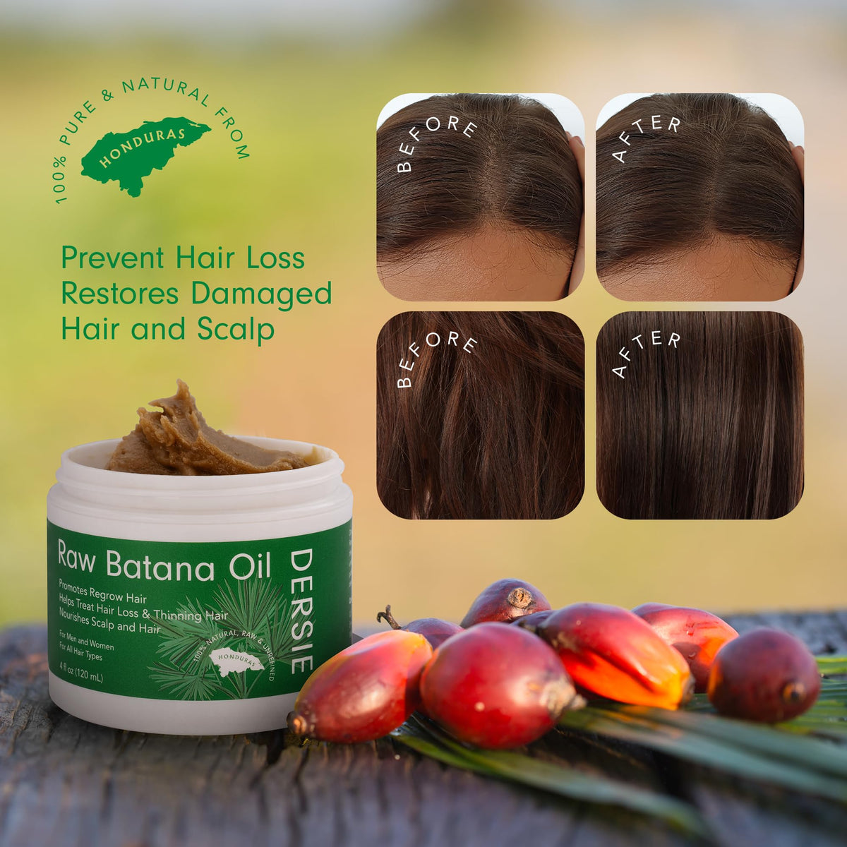 Dersie Raw Batana Oil for Hair, Unrefined Solid, Pure & Organic
