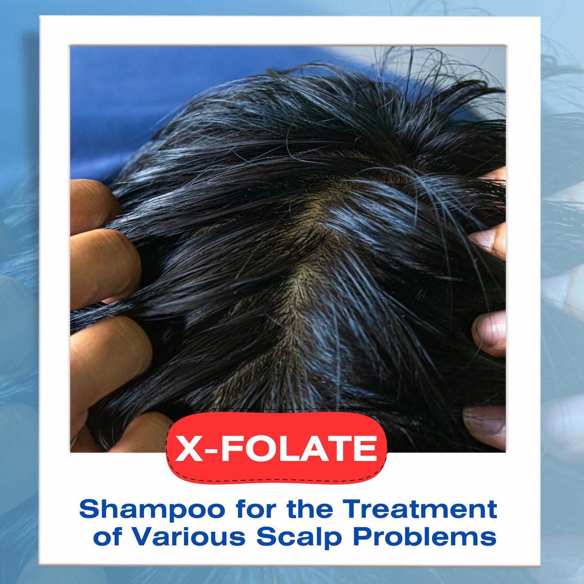 Mediceuticals X-Folate Anti-Dandruff Shampoo for Scalp Relief