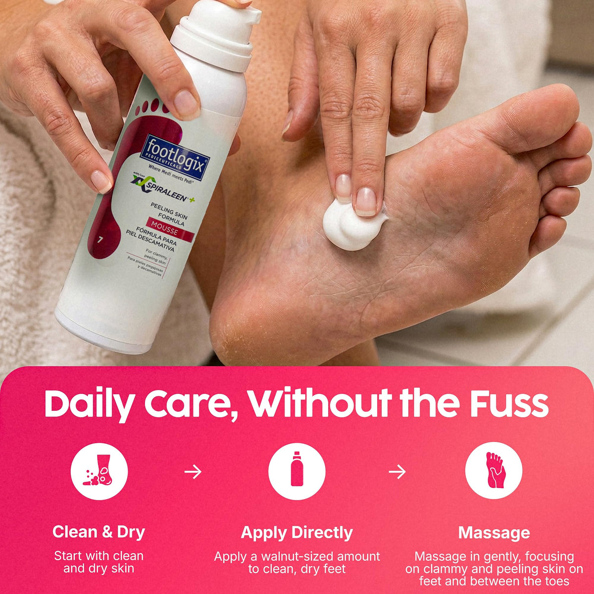FOOTLOGIX Peeling Skin Formula Foot Care Mousse, 4.23 oz