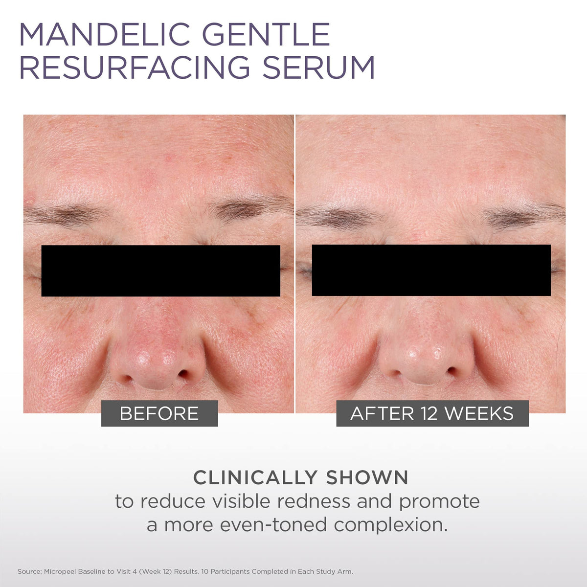 Glytone Micro-Peel 10% Mandelic Acid Resurfacing Serum