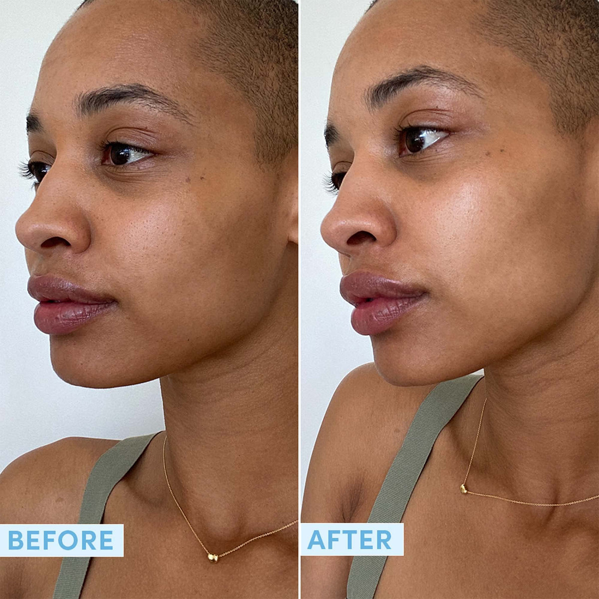 Sand & Sky Hyaluronic Acid Gel Cream Face Moisturizer