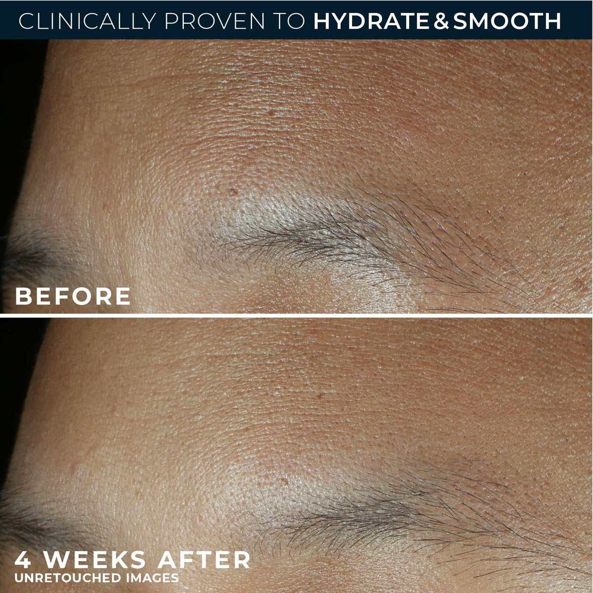 RoC Retinol Correxion Max Hydration Anti-Aging Face Moisturizer with Hyaluronic Acid