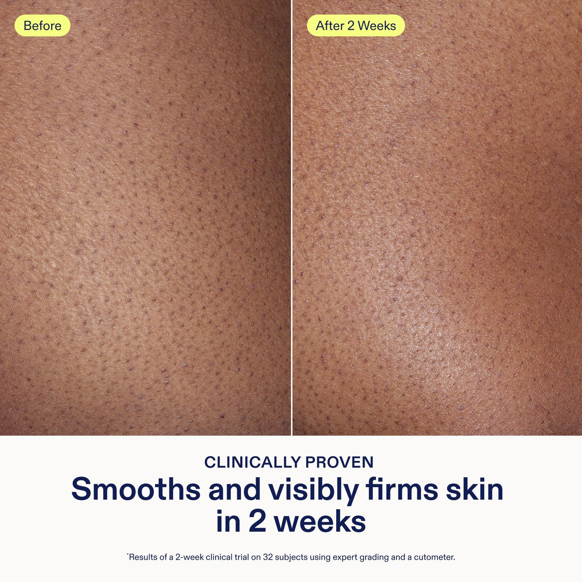 Skinfix AHA/BHA Renewing Body Cream – Skin-Softening Moisturizer