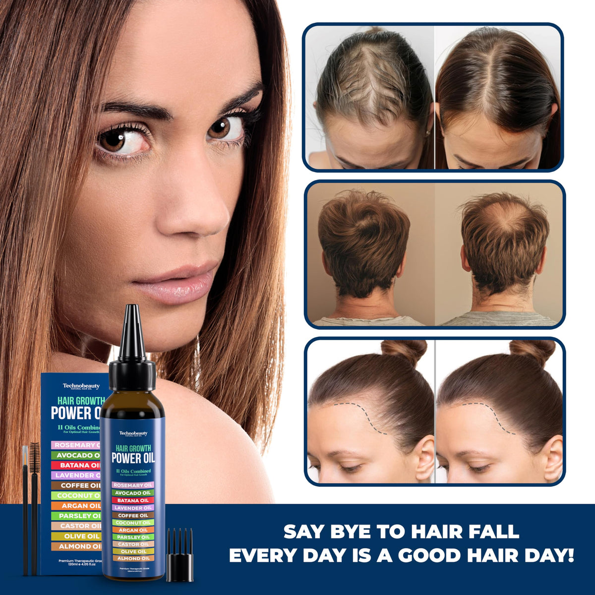Rosemary Hair Growth Oil with 11 Botanical Oils for Hair Care