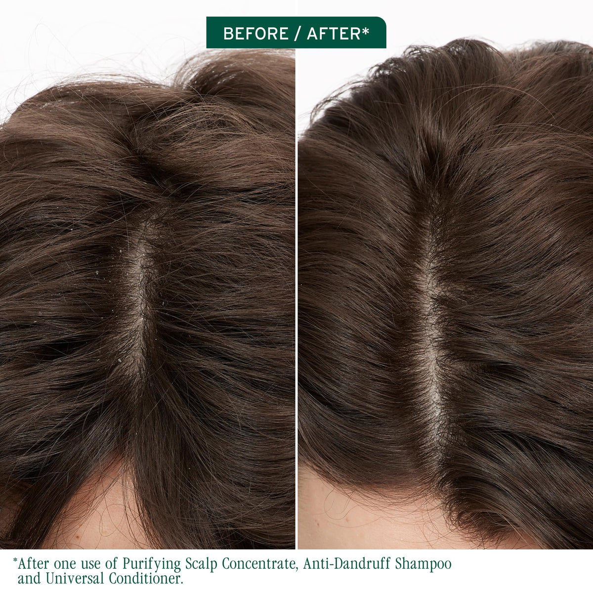 Biolage Scalp Sync Anti-Dandruff Shampoo - Dandruff Relief & Scalp Care