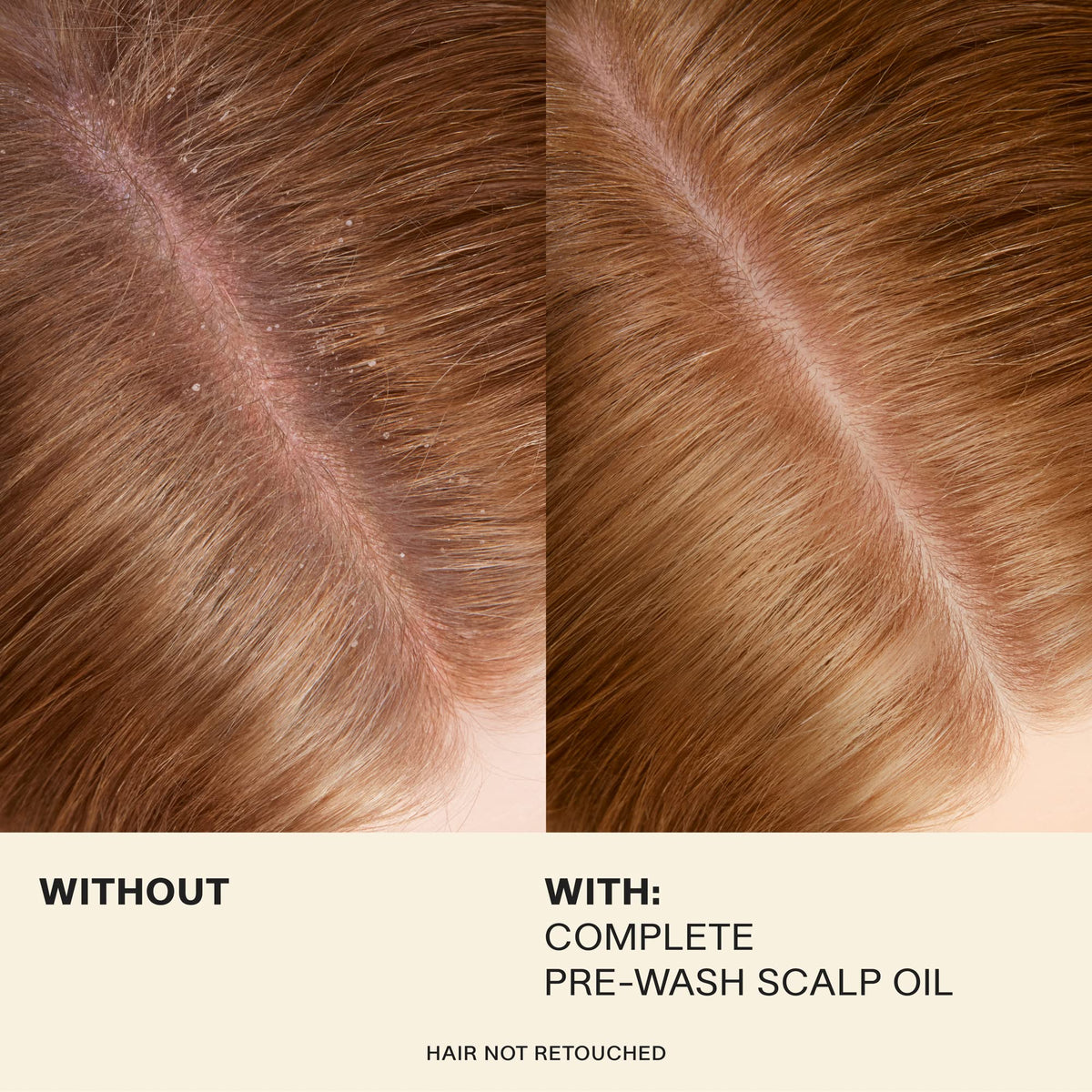 JVN Complete Pre-Wash Scalp Oil with Rosemary Extract, 1.7 Fl Oz