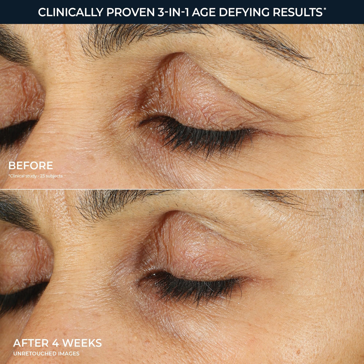 RoC Retinol Correxion Under Eye Cream for Dark Circles, Puffiness & Wrinkles