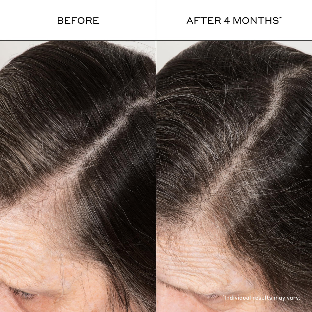 Zenagen Densifying Hair Serum for Thicker-Looking, Fuller Hair