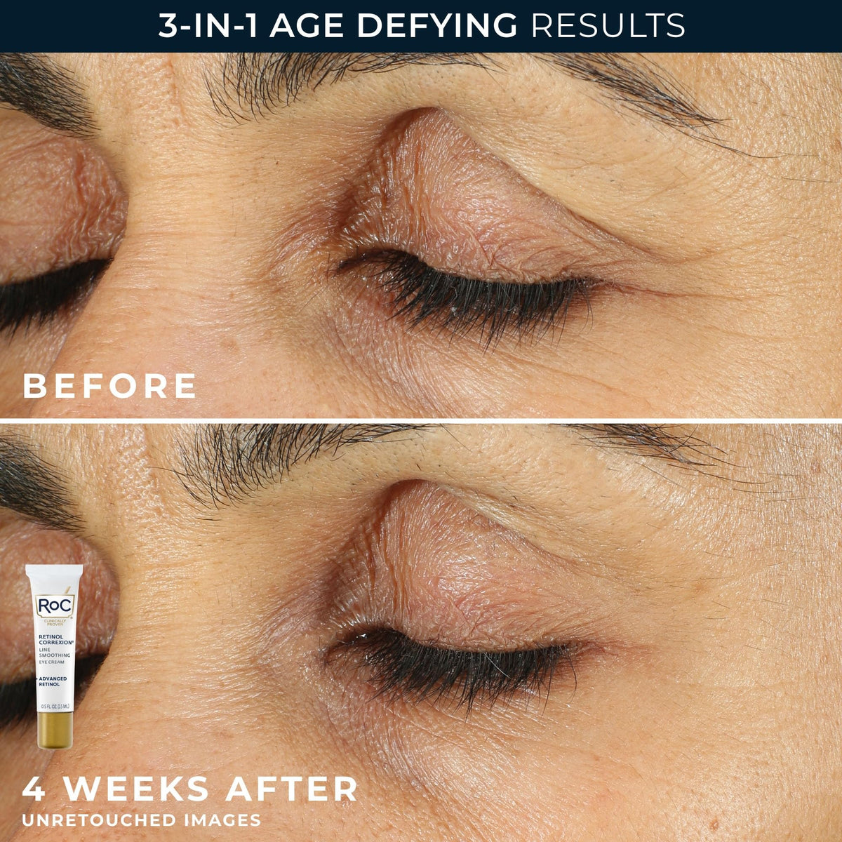 RoC Clinical Retinol Anti-Aging Skincare Routine Kit